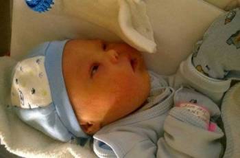 Η γυναίκα του παράτησε το μωρό της επειδή έχει σύνδρομο Down