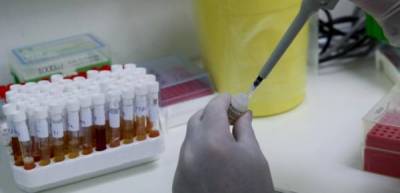 Κλειστά από σήμερα μικροβιολογικά και ακτινολογικά εργαστήρια - Τα αιτήματα των εργαστηριακών γιατρών