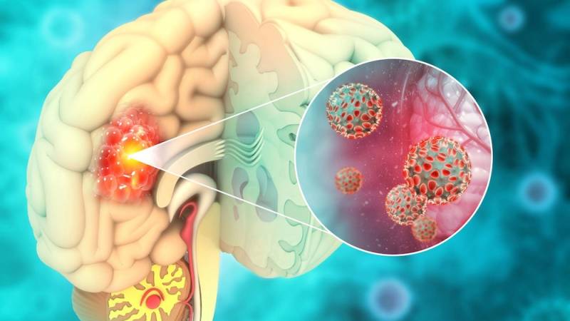 Όγκος εγκεφάλου: Σύγχρονη και εξατομικευμένη θεραπευτική προσέγγιση