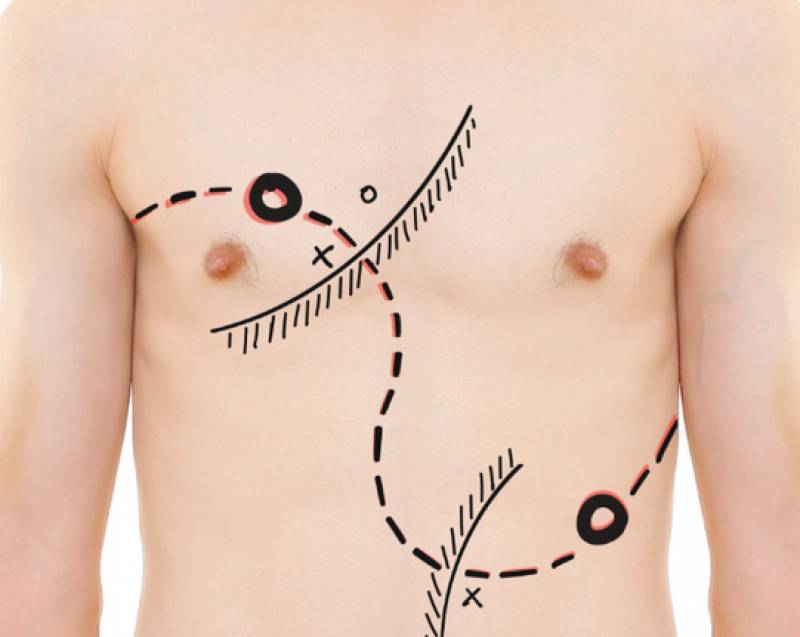 Παπαλεξίου και Πλιός στην περφόρμανς "Τρωάδες - Anima Captus"