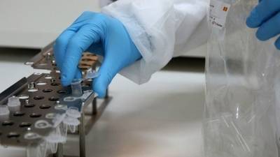 Covid-19: 39 θάνατοι, 25 διασωληνωμένοι - 5 κρούσματα της νέας παραλλαγής Pirola