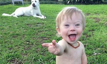 Η απάντηση μιας μητέρας παιδιού με σύνδρομο down σε κάποιον που αποκάλεσε το παιδί της άσχημο