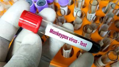 Ευλογιά των πιθήκων: Πάνω από 50.000 κρούσματα σε όλον τον κόσμο