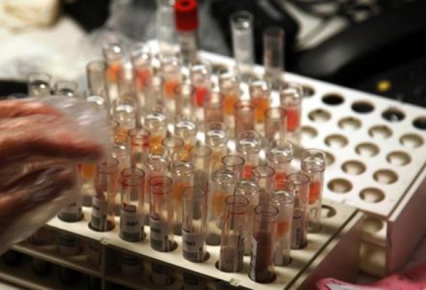 Νεαροί  ήρθαν στην Καλαμάτα και εξετάστηκαν για AIDS