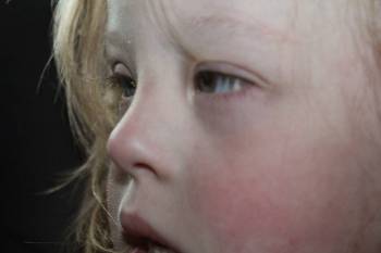 Δεν θα αφήσω την κόρη μου που έχει Σύνδρομο Down να ορίζεται από μια “Λίστα”