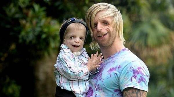 Πώς μία σπάνια γενετική πάθηση ένωσε έναν 30χρονο με ένα 2χρονο αγοράκι