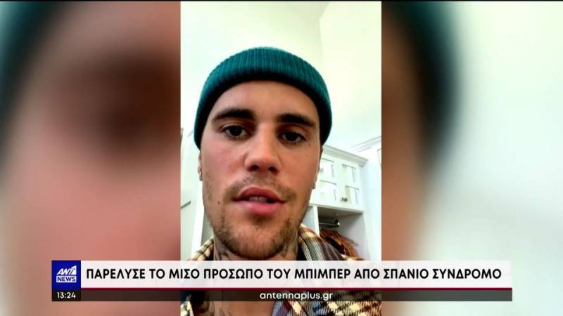 Τζάστιν Μπίμπερ: Παρέλυσε το πρόσωπο του από σπάνιο σύνδρομο (βίντεο)