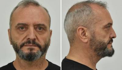 Κολωνός: Αυτός είναι ο 53χρονος που βίαζε και εξέδιδε τη 12χρονη (βίντεο)